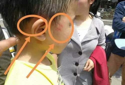 第581页